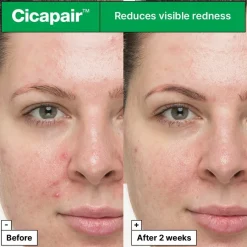 Dr. Jartu002B Cicapair So Soothing Treatment von Dr. Jart+