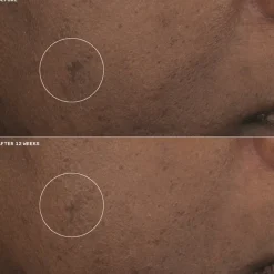 Clinique Even Better Clinical Brightening Moisturizer