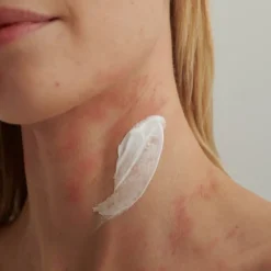 DADO SENS EXTRODERM INTENSIVCREME - bei trockener Haut und Neurodermitis von