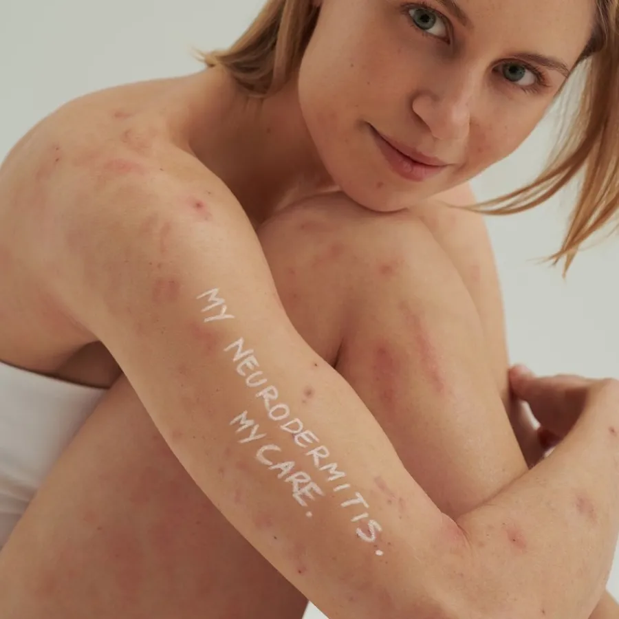 DADO SENS EXTRODERM INTENSIVCREME - bei trockener Haut und Neurodermitis von