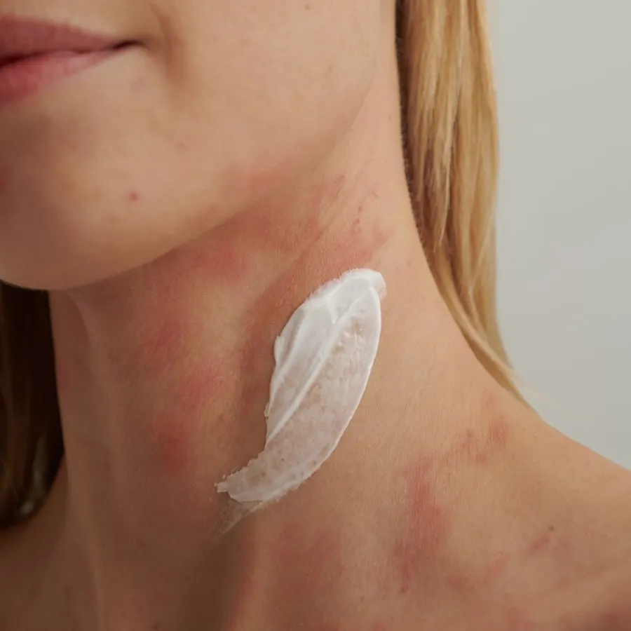 DADO SENS EXTRODERM INTENSIVCREME - bei trockener Haut und Neurodermitis von