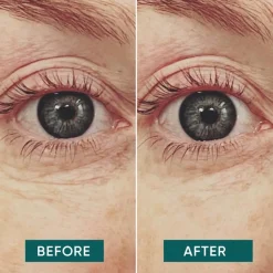 APRICOT Gesicht Augen Pads mit Vitamin C - glow getter von