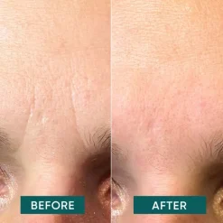 APRICOT Gesicht Facial Patches Aloe Vera - aloe you vera much von Hot