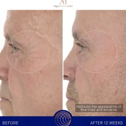 Augustinus Bader Gesicht The Retinol Serum von