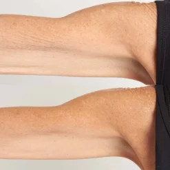 Perricone MD High Potency Classic Hyalurionic Intensive Body Therapy von Best