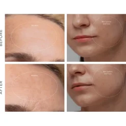 Foreo KIWI derma von