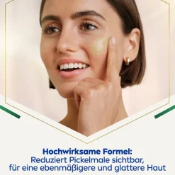 NIVEA Luminous630 Anti Pigmentflecken Serum von Clearance