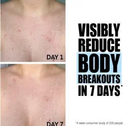 The INKEY List Peeling Glycolic Acid Exfoliating Body Stick von Outlet