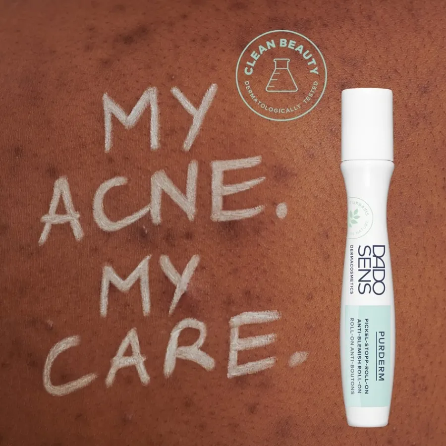 DADO SENS PURDERM PICKEL-STOPP ROLL-ON - bei unreiner Haut von Hot