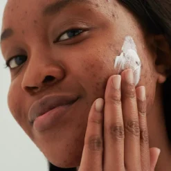 DADO SENS PURDERM WASCHCREME - bei unreiner Haut von