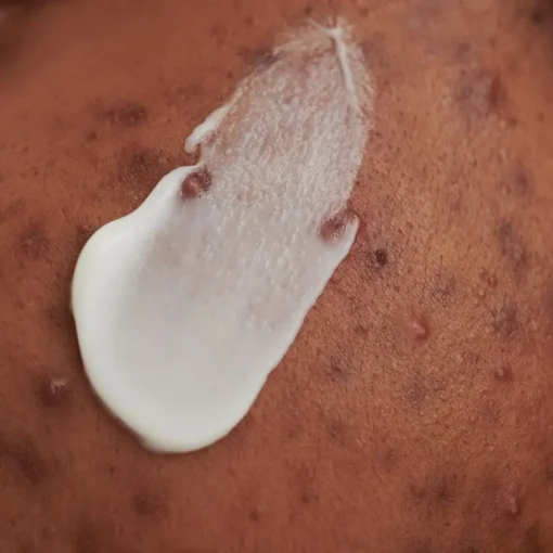DADO SENS PURDERM WASCHCREME - bei unreiner Haut von
