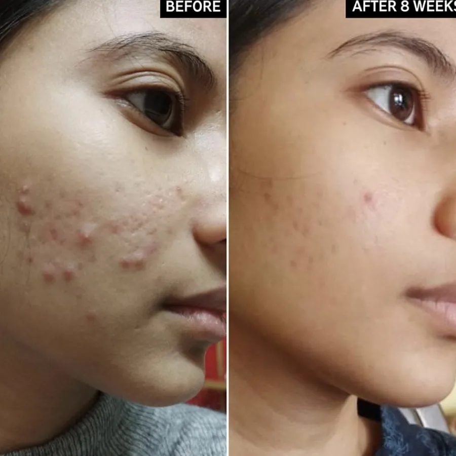 The INKEY List Reiniger Salicylic Acid Cleanser von