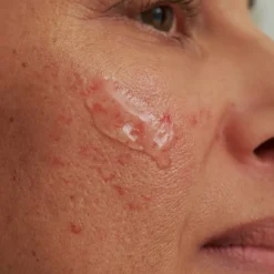 DADO SENS SENSACEA INTENSIVSERUM - bei hypersensibler Haut & Couperose von