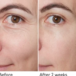 By Terry Seren Hyaluronic Global Serum von Sale