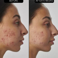 The INKEY List Seren SuperSolutions 1% Retinol Serum von