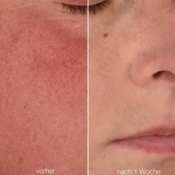 Dermalogica UltraCalming Stabilizing Repair Cream von Outlet